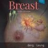 Diagnostic Imaging: Breast 3rd Edition