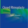 Closed Rhinoplasty: The Next Generation 1st ed. 2019 Edition