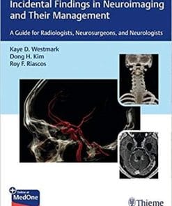 Incidental Findings in Neuroimaging and Their Management: A Guide for Radiologists, Neurosurgeons, and Neurologists 1st Edition