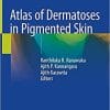 Atlas of Dermatoses in Pigmented Skin 1st ed. 2021 Edition