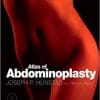 Atlas of Abdominoplasty: Expert Consult – Online (Techniques in Aesthetic Plastic Surgery) 1st Edition