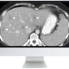 SAR Disease-Focused Panels: Cancer Imaging and Reporting Guidelines 2021