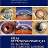Atlas de técnicas complejas en la cirugía del segmento anterior (Spanish Edition)