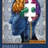 Diseases of the Nervous System (2nd ed.) (PDF)