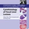 Cytohistology of Focal Liver Lesions