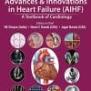 Advances & Innovations In Heart Failure (AIHF): A Textbook Of Cardiology (PDF)