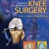 Pediatric and Adolescent Knee Surgery (EPUB)