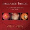 Intraocular Tumors: An Atlas and Textbook (High Quality CHM)