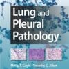 Lung and Pleural Pathology (EPUB)