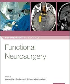 Functional Neurosurgery (Neurosurgery by Example)
