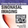 Sinonasal Imaging (Clinico Radiological Series) (PDF)