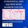 Congenital and Acquired Bone Marrow Failure (PDF)