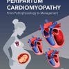 Peripartum Cardiomyopathy: From Pathophysiology to Management (PDF)