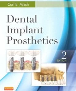Dental Implant Prosthetics, 2nd Edition (PDF)