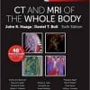 CT and MRI of the Whole Body, 2-Volume Set, 6th Edition (PDF)