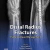 Distal Radius Fractures: Evidence-Based Management (True PDF+ToC+Index+Videos)