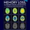 Memory Loss, Alzheimer’s Disease and Dementia: A Practical Guide for Clinicians, 3rd Edition (PDF)