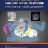 Hypoxic Respiratory Failure in the Newborn: From Origins to Clinical Management (PDF)
