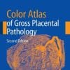 Color Atlas of Gross Placental Pathology / Edition 2 (PDF)