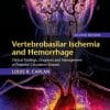 Vertebrobasilar Ischemia and Hemorrhage, 2nd Edition (PDF)