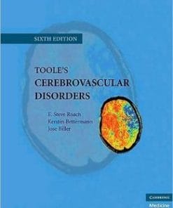Toole’s Cerebrovascular Disorders, 6th Edition (PDF)