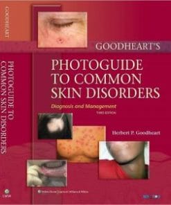 Goodheart’s Photoguide to Common Skin Disorders: Diagnosis and Management, 3rd Edition (PDF)