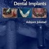 Osseointegration and Dental Implants (PDF)
