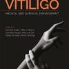 Vitiligo: Medical and Surgical Managmement (PDF)