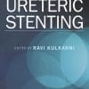 Ureteric Stenting (PDF)