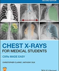 Chest X-Rays for Medical Students: CXRs Made Easy, 2nd Edition