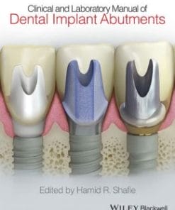 Clinical and Laboratory Manual of Dental Implant Abutments (PDF)