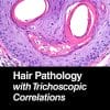 Hair Pathology with Trichoscopic Correlations (PDF)