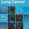 Lung Cancer: Standards of Care (PDF)