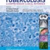 Tuberculosis: A Comprehensive Clinical Reference (PDF)