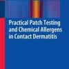Practical Patch Testing and Chemical Allergens in Contact Dermatitis (EPUB)