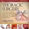 Master Techniques in Surgery: Thoracic Surgery: Transplantation, Tracheal Resections, Mediastinal Tumors, Extended Thoracic Resections (EPUB)