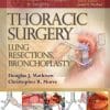 Master Techniques in Surgery: Thoracic Surgery: Lung Resections (EPUB)