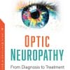 Optic Neuropathy: From Diagnosis to Treatment (PDF)