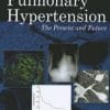 Pulmonary Hypertension: The Present and Future (PDF)