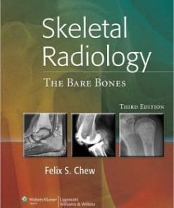 Skeletal Radiology: The Bare Bones, 3rd Edition