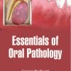 Essentials Of Oral Pathology (PDF)