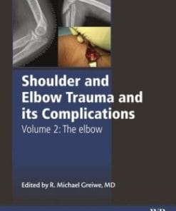 Shoulder and Elbow Trauma and its Complications, Volume 2: The Elbow