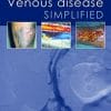 Venous Disease Simplified (PDF)