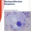 Fast Facts: Myeloproliferative Neoplasms (PDF)