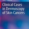 Clinical Cases in Dermoscopy of Skin Cancers (Clinical Cases in Dermatology) (PDF)