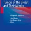 Mesenchymal Tumors of the Breast and Their Mimics (PDF)