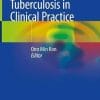 Tuberculosis in Clinical Practice (PDF)