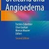 Urticaria and Angioedema, 2nd Edition (PDF)