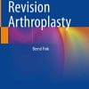 Femoral Revision Arthroplasty (PDF)