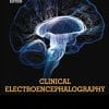 Clinical Electroencephalography, 2e (True PDF)